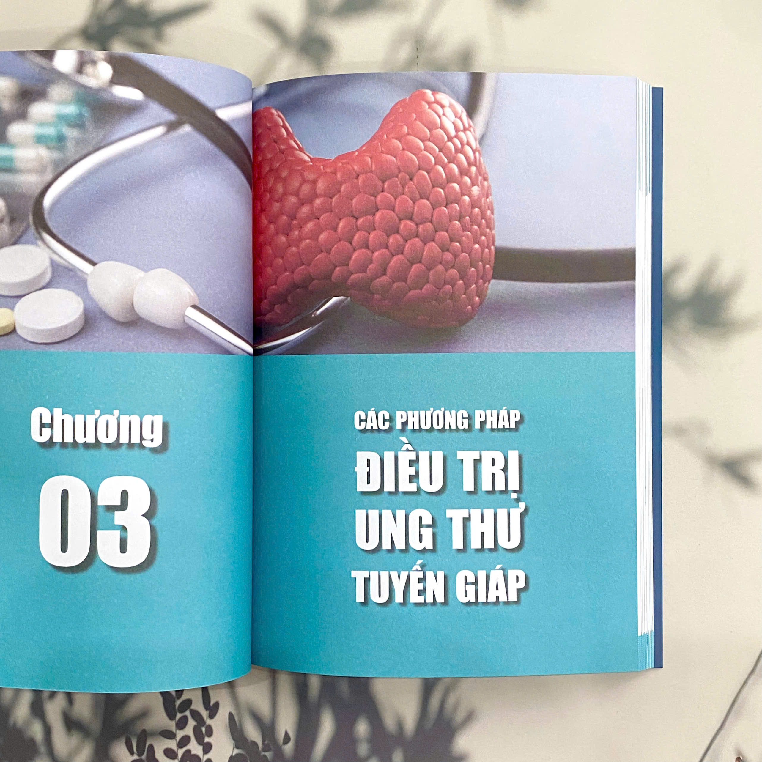 Điều Trị Ung Thư Tuyến Giáp Thể Biệt Hóa - Khoa Học, An Toàn Và Hiệu Quả - Ảnh 5
